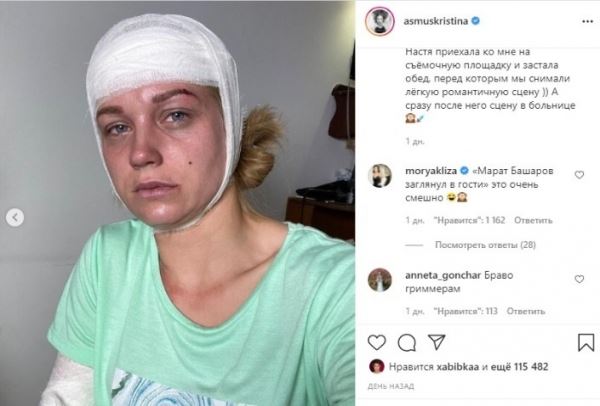 "Покалечилась снова": Кристина Асмус испугала поклонников фотографией с перебинтованной головой